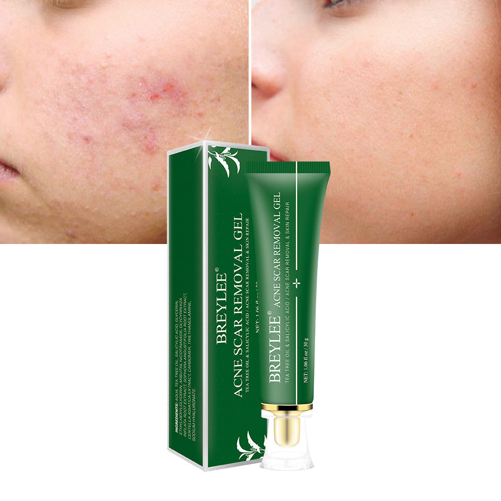 Acne Scar Removal Gel Tea Tree Qu Dou Printing